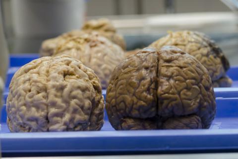 Brain. The Dutch for "brain" is "hersenen". Brain. The Dutch for "brain" is "hersenen".