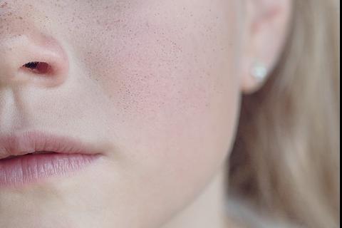 Cheeks. The Dutch for "cheeks" is "wangen". Cheeks. The Dutch for "cheeks" is "wangen".