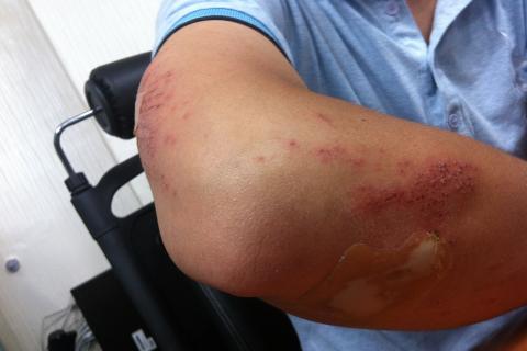 Wound. The Dutch for "wound" is "wond". Wound. The Dutch for "wound" is "wond".