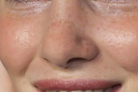 Nose. The French for "nose" is "nez". Nose. The French for "nose" is "nez".
