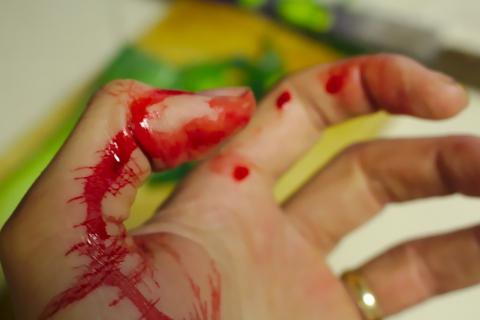 To cut; to wound. The Thai for "to cut; to wound" is "บาด". To cut; to wound. The Thai for "to cut; to wound" is "บาด".