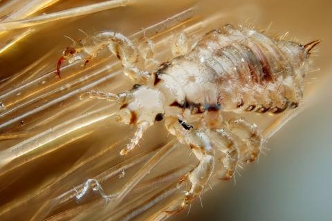 Lice. The Thai for "lice" is "เหา".