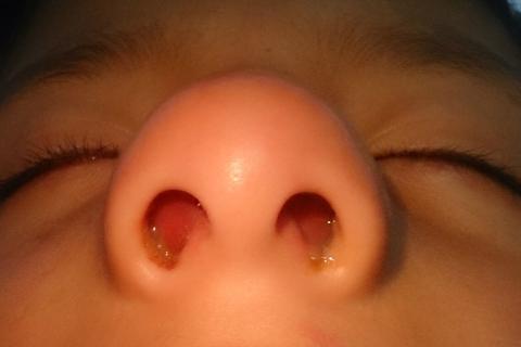 Snot; mucus. The Thai for "snot; mucus" is "น้ำมูก". Snot; mucus. The Thai for "snot; mucus" is "น้ำมูก".