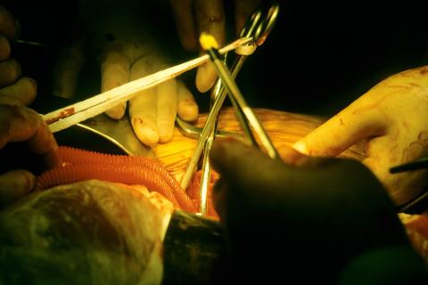 Operation; surgery. The Thai for "operation; surgery" is "การผ่าตัด". Operation; surgery. The Thai for "operation; surgery" is "การผ่าตัด".